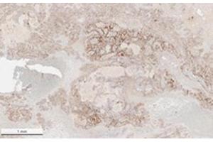 Image no. 7 for anti-SARS-Coronavirus Nucleocapsid Protein (SARS-CoV N) antibody (ABIN6952544)