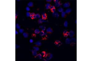 Image no. 2 for anti-Cathelicidin Antimicrobial Peptide (CAMP) antibody (ABIN571374)