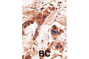 Immunohistochemistry (IHC) image for anti-BMP2 Inducible Kinase (BMP2K) (Center) antibody (ABIN2159526)