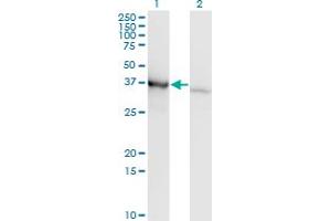 Image no. 2 for anti-Poly(rC) Binding Protein 1 (PCBP1) (AA 181-280) antibody (ABIN518653)