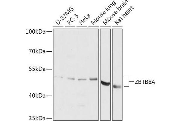 ZBTB8A Antikörper  (AA 200-400)