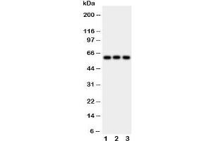 Image no. 2 for anti-Hexosaminidase A (HEXA) (Middle Region) antibody (ABIN3031197)