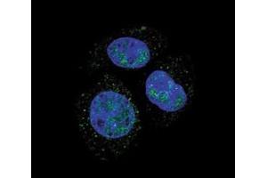 Image no. 5 for anti-Retinoblastoma Protein (Rb Protein) (pSer811) antibody (ABIN3029756)