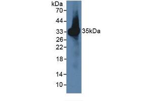 Image no. 3 for Chemokine (C-C Motif) Ligand 7 (CCL7) ELISA Kit (ABIN6574138)