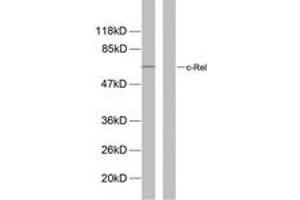Image no. 1 for anti-REL proto-oncogene (c-Rel) (AA 470-519), (pSer503) antibody (ABIN1531963)