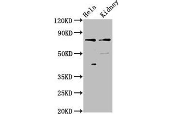 CLCNKB 抗体  (AA 538-687)