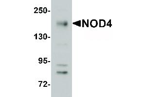 Image no. 1 for anti-NLR Family, CARD Domain Containing 5 (NLRC5) (N-Term) antibody (ABIN6655924)