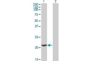 Image no. 1 for anti-MOB1, Mps One Binder Kinase Activator-Like 2C (MOBKL2C) (AA 1-216) antibody (ABIN530967)