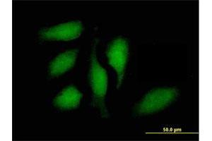 Image no. 4 for anti-Signal Transducer and Activator of Transcription 1, 91kDa (STAT1) (AA 1-712) antibody (ABIN520534)