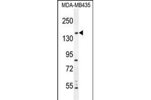 CAMSAP1 Antikörper  (N-Term)