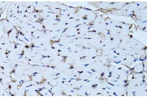 Immunohistochemistry of paraffin-embedded Mouse heart using FABP4 Polyclonal Antibody at dilution of 1:100 (40x lens).