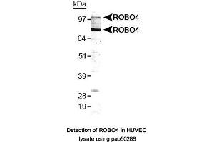 Image no. 1 for anti-Roundabout, Axon Guidance Receptor, Homolog 4 (ROBO4) (AA 200-300), (Internal Region) antibody (ABIN363597)