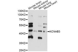 Image no. 1 for anti-Potassium Voltage-Gated Channel, Shaker-Related Subfamily, beta Member 3 (KCNAB3) antibody (ABIN6292719)