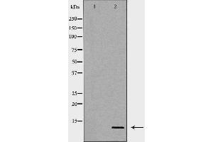 Image no. 2 for anti-Secretoglobin, Family 1A, Member 1 (Uteroglobin) (SCGB1A1) antibody (ABIN6264939)