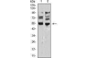 Image no. 4 for anti-Microphthalmia-Associated Transcription Factor (MITF) (AA 1-114) antibody (ABIN5542529)