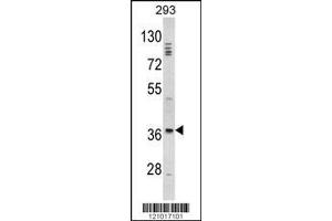 Image no. 1 for anti-Distal-Less Homeobox Protein 2 (DLX2) (AA 194-222) antibody (ABIN390871)