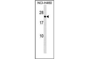 Image no. 1 for anti-RAB41, Member RAS Oncogene Family (RAB41) (AA 136-165), (C-Term) antibody (ABIN954418)