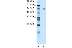 Image no. 2 for anti-FEZ Family Zinc Finger 2 (FEZF2) (C-Term) antibody (ABIN2781047)