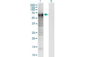 Image no. 1 for anti-Plastin 3 (PLS3) (AA 1-630) antibody (ABIN948273)