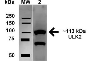 Image no. 1 for anti-Unc-51 Like Kinase 2 (ULK2) (AA 558-569) antibody (ABIN5066155)