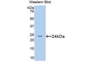 Afamin antibody  (AA 210-403)