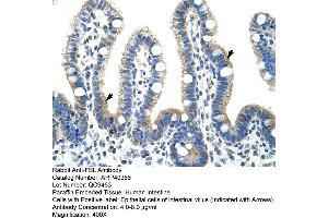 Image no. 2 for anti-Fibrillarin (FBL) (N-Term) antibody (ABIN2778775)