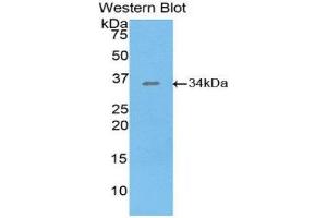 Image no. 1 for anti-Salt-Inducible Kinase 2 (SIK2) (AA 655-925) antibody (ABIN1860558)