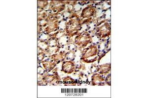 Image no. 3 for anti-Guanine Monophosphate Synthetase (GMPS) (C-Term) antibody (ABIN2437723)
