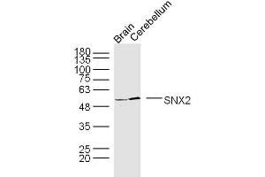 Image no. 1 for anti-Sorting Nexin 2 (SNX2) (AA 121-230) antibody (ABIN1714872)