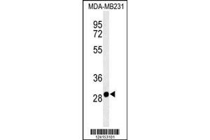 Image no. 1 for anti-Solute Carrier Family 25, Member 37 (SLC25A37) (AA 309-338), (C-Term) antibody (ABIN653670)