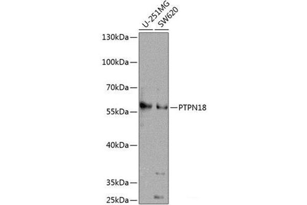 PTPN18 抗体