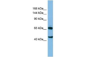 Image no. 1 for anti-Cytoplasmic Linker Associated Protein 2 (CLASP2) (C-Term) antibody (ABIN2786099)