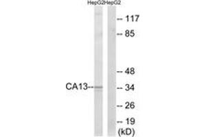 Image no. 1 for anti-Carbonic Anhydrase XIII (CA13) (AA 141-190) antibody (ABIN1534725)