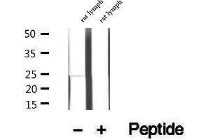Image no. 2 for anti-Lysosomal Protein Transmembrane 4 beta (LAPTM4B) (Internal Region) antibody (ABIN6262909)