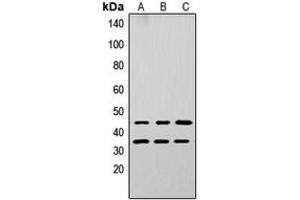 Image no. 2 for anti-Apolipoprotein L, 3 (APOL3) (Center) antibody (ABIN2705495)