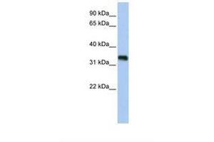 GLYATL3 antibody  (AA 38-87)