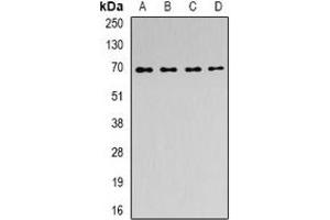 Image no. 2 for anti-Acyl-CoA Dehydrogenase Family, Member 9 (ACAD9) antibody (ABIN3197535)