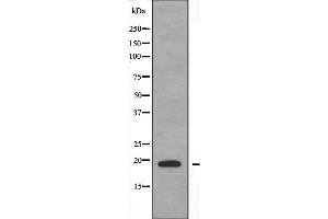 Image no. 2 for anti-Tumor Necrosis Factor (Ligand) Superfamily, Member 15 (TNFSF15) (C-Term) antibody (ABIN6259216)