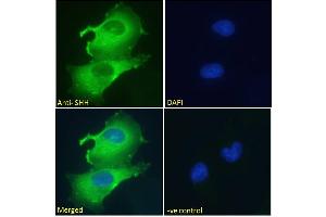 Image no. 4 for anti-Sonic Hedgehog (SHH) (C-Term) antibody (ABIN6391361)