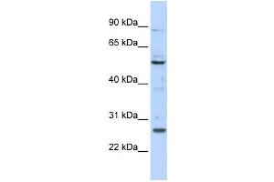 Image no. 1 for anti-Homeobox C5 (HOXC5) antibody (ABIN2458390)