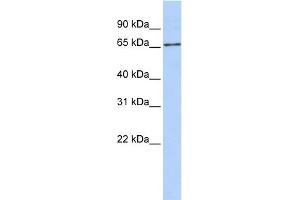 Image no. 1 for anti-Solute Carrier Family 27 (Fatty Acid Transporter), Member 6 (SLC27A6) (Middle Region) antibody (ABIN2781556)