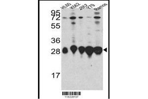 Image no. 1 for anti-High Mobility Group Box 2 (HMGB2) (AA 92-118) antibody (ABIN391291)