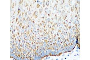 Immunohistochemistry of paraffin-embedded Human esophagus using MTCO2 Polyclonal Antibody at dilution of 1:100 (40x lens).