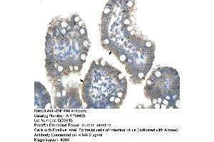 Image no. 3 for anti-Zinc Finger and SCAN Domain Containing 25 (ZSCAN25) (Middle Region) antibody (ABIN2775823)