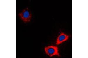 Image no. 3 for anti-ATP-Binding Cassette, Sub-Family B (MDR/TAP), Member 10 (ABCB10) (Center) antibody (ABIN2705370)