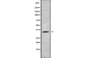 Image no. 1 for anti-Homeobox D11 (HOXD11) (Internal Region) antibody (ABIN6262353)