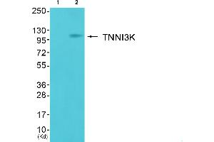 Image no. 2 for anti-TNNI3 Interacting Kinase (TNNI3K) (Internal Region) antibody (ABIN1852110)