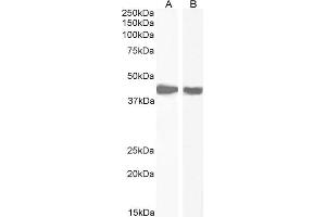 Image no. 5 for anti-Actin, alpha 2, Smooth Muscle, Aorta (ACTA2) (N-Term) antibody (ABIN185271)