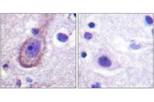 Immunohistochemistry analysis of paraffin-embedded human brain, using Kv7.