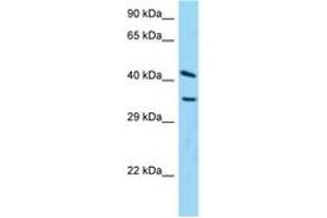 Image no. 1 for anti-ADP-Ribosylarginine Hydrolase (ADPRH) (C-Term) antibody (ABIN6748205)